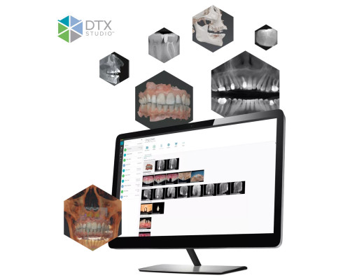 DTX Studio Clinic Active Pro - программное обеспечение для пользователей оборудования DEXIS