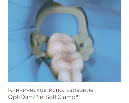 SoftClamp универсальные пластиковые кламмер для жевательной группы зубов Kerr (5 шт.), арт. 5250