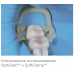 SoftClamp универсальные пластиковые кламмер для жевательной группы зубов Kerr (5 шт.), арт. 5250