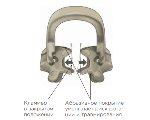 SoftClamp универсальные пластиковые кламмер для жевательной группы зубов Kerr (5 шт.), арт. 5250