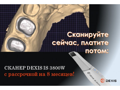 Рассрочка на беспроводной интраоральный сканер DEXIS IS 3800W