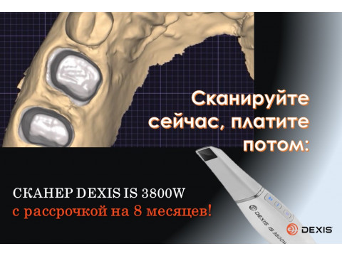 Рассрочка на беспроводной интраоральный сканер DEXIS IS 3800W
