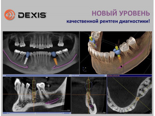 Уникальный томограф от DEXIS